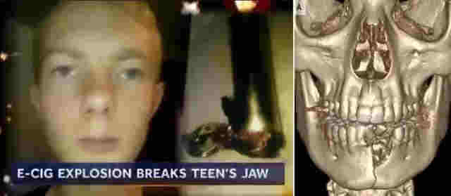 33人致死、1500人染病，如今終于禁售，電子煙“好”日子到頭 