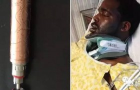 smok電子煙霧化器電阻