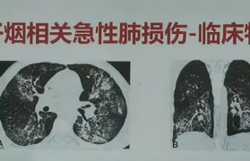 電子煙霧化器 推薦，電子煙霧化器排名